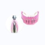 MINI Dental Burs