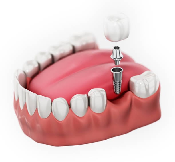 MINI Dental Burs